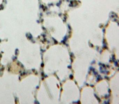 Polyclonal Antibody to Nucleoporin 88 (NUP88)