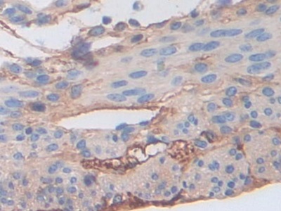 Polyclonal Antibody to Fibrinogen Beta Chain (FGB)