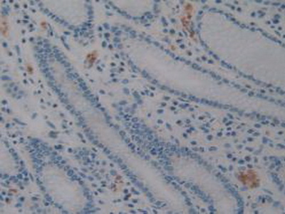 Polyclonal Antibody to Cluster Of Differentiation 56 (CD56)