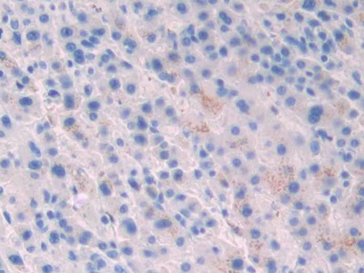 Polyclonal Antibody to Corticosteroid Binding Globulin (CBG)