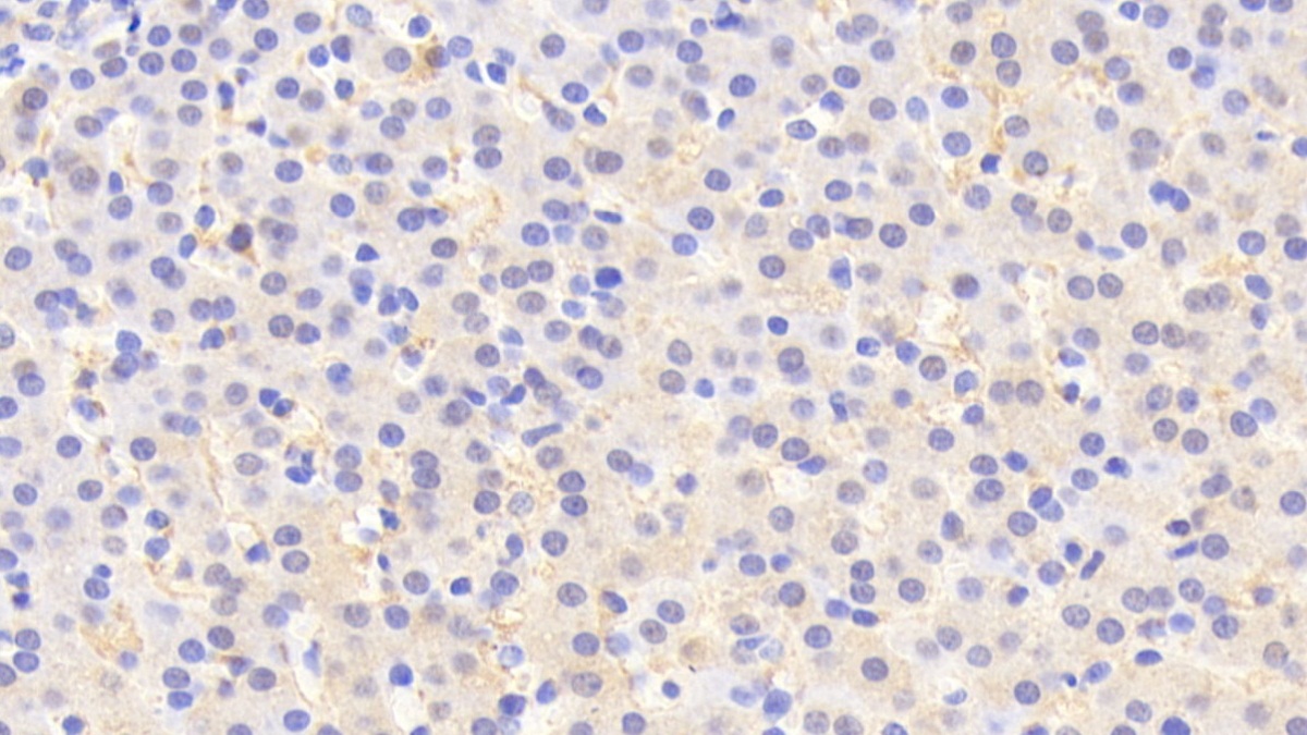 Polyclonal Antibody to Corticosteroid Binding Globulin (CBG)