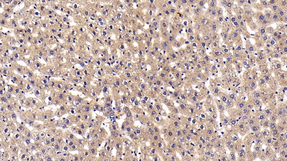 Polyclonal Antibody to Corticosteroid Binding Globulin (CBG)