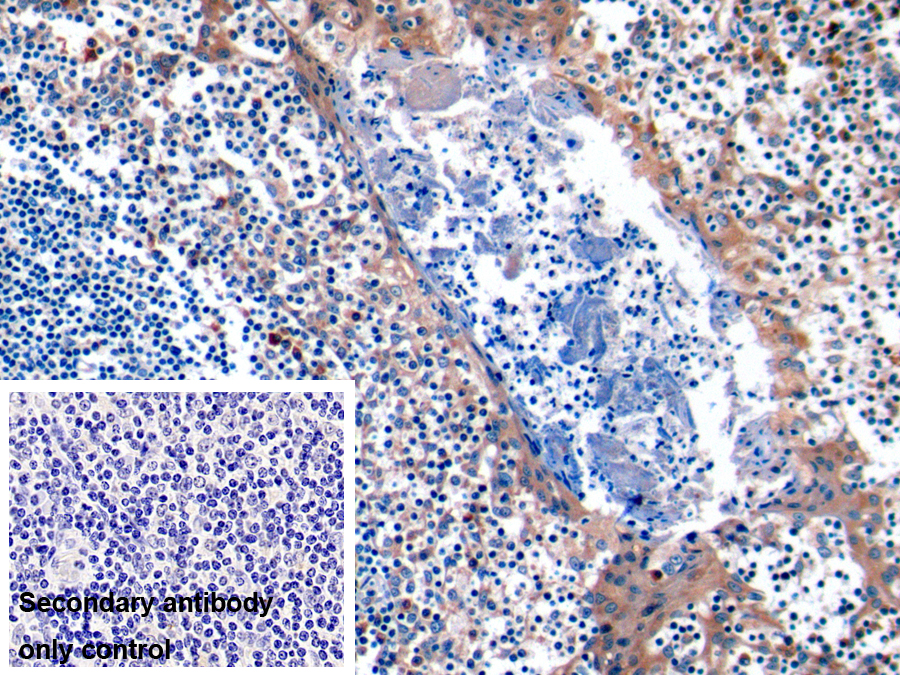 Polyclonal Antibody to Cytotoxic T-Lymphocyte Associated Antigen 4 (CTLA4)