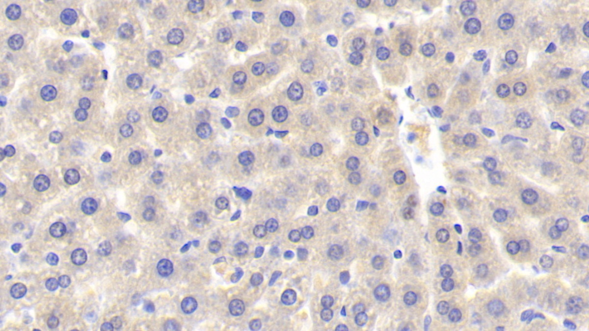 Polyclonal Antibody to Sulfotransferase 1A1 (SULT1A1)