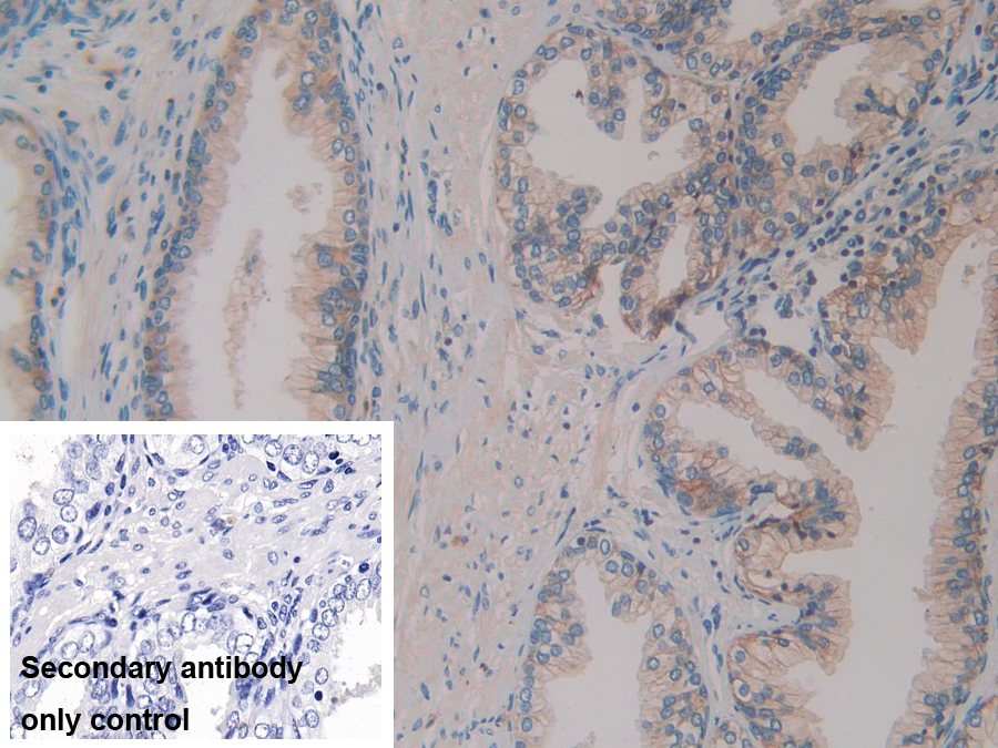 Polyclonal Antibody to Membrane Cofactor Protein (MCP)