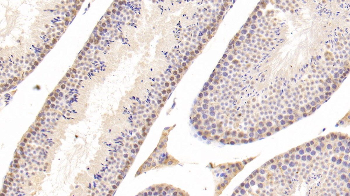 Polyclonal Antibody to Cathepsin D (CTSD)