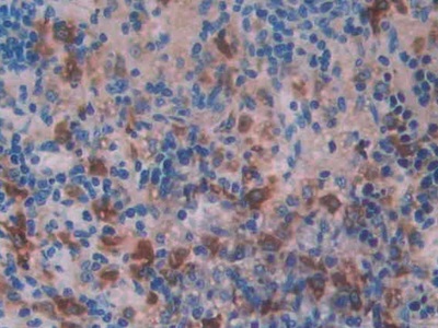 Polyclonal Antibody to Cathepsin D (CTSD)