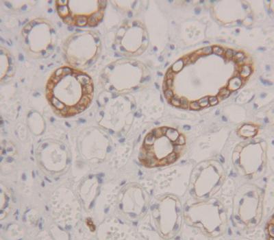 Polyclonal Antibody to Integrin Alpha V (ITGaV)