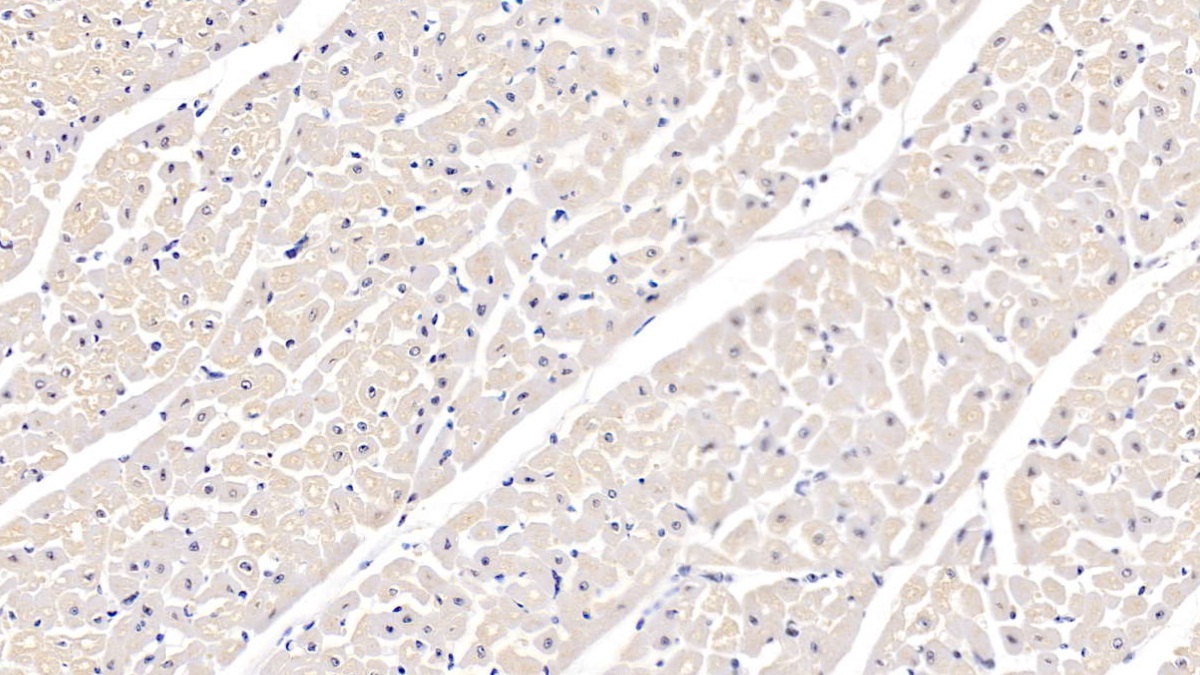 Polyclonal Antibody to Integrin Alpha 5 (ITGa5)