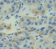 Polyclonal Antibody to Integrin Alpha 5 (ITGa5)