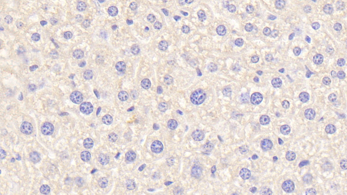 Polyclonal Antibody to Complement C4-B (C4B)