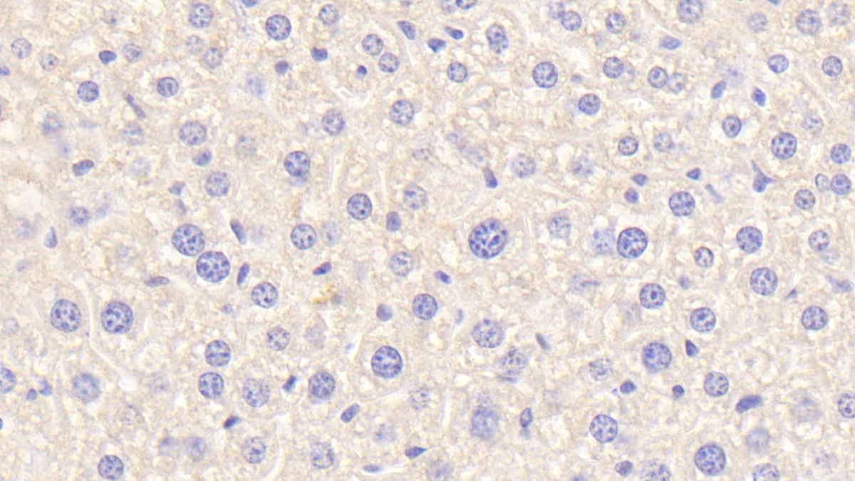 Polyclonal Antibody to Complement C4-B (C4B)