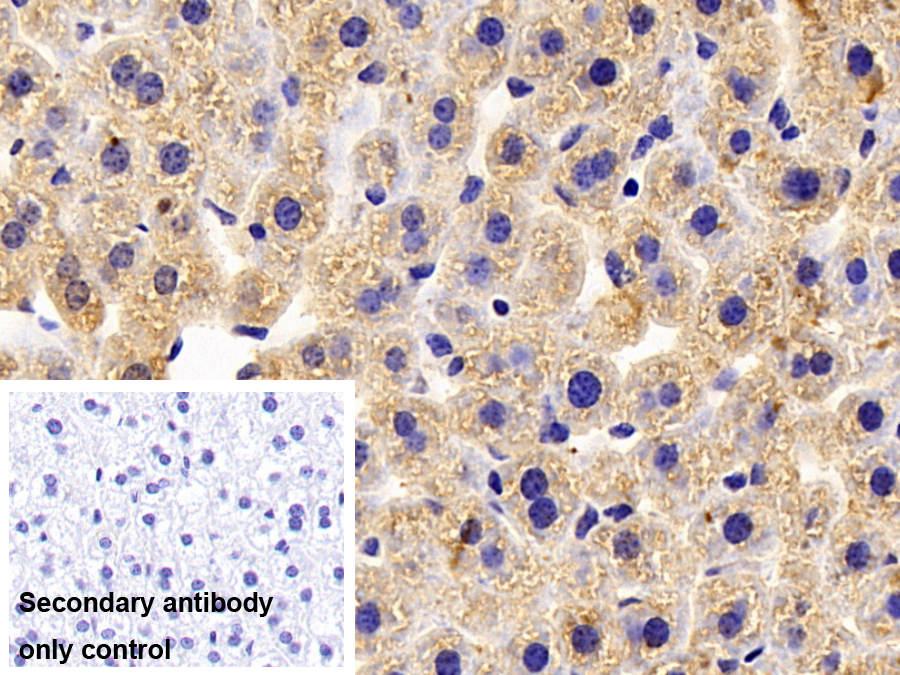 Polyclonal Antibody to Complement C4-B (C4B)
