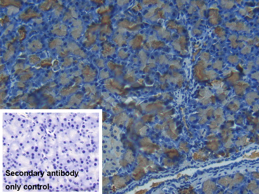 Polyclonal Antibody to Chymotrypsin C (CTRC)