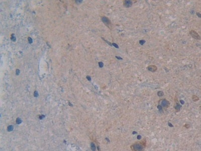 Polyclonal Antibody to Glutathione Reductase (GR)