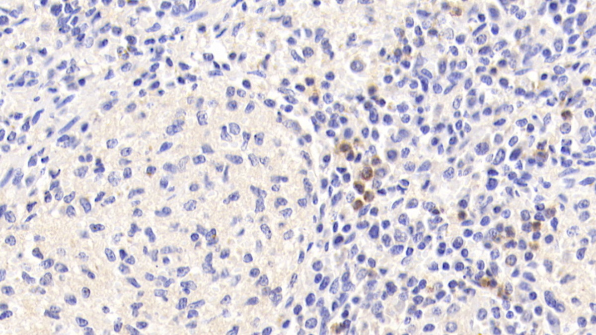 Polyclonal Antibody to Tetraspanin 25 (TSPAN25)