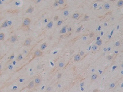 Polyclonal Antibody to Microtubule Associated Protein 2 (MAP2)