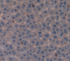 Polyclonal Antibody to Involucrin (INV)