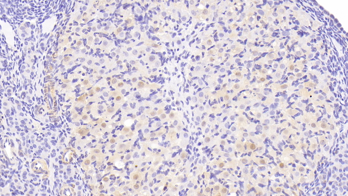 Polyclonal Antibody to Activating Transcription Factor 1 (ATF1)