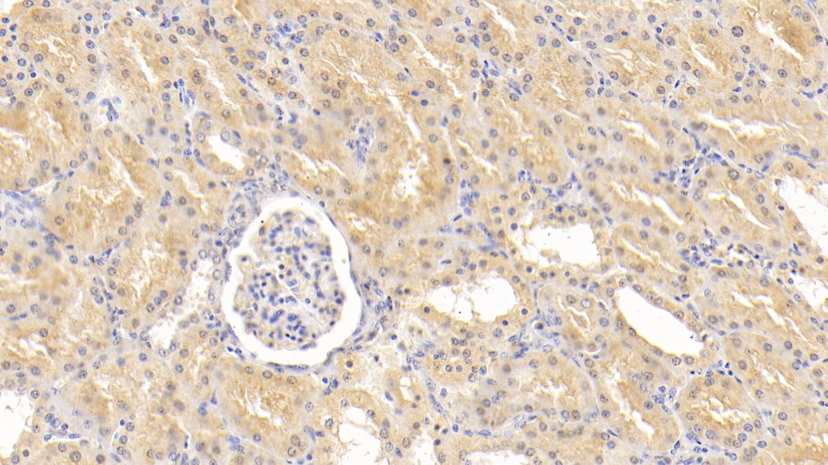 Polyclonal Antibody to Adipose Differentiation Related Protein (ADRP)