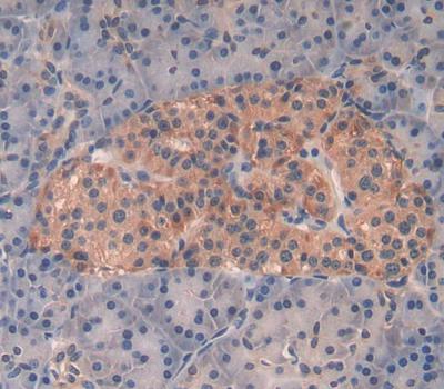 Polyclonal Antibody to Apoptosis Signal Regulating Kinase 1 (ASK1)