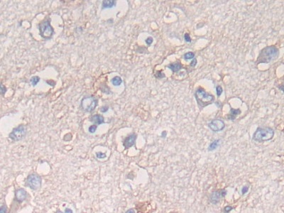 Polyclonal Antibody to Activating Transcription Factor 6 (ATF6)