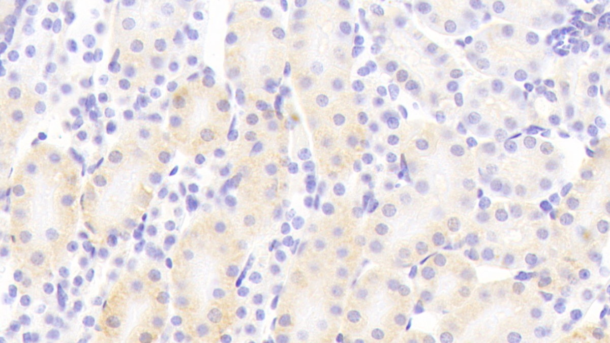 Polyclonal Antibody to Protocadherin Beta 2 (PCDHb2)