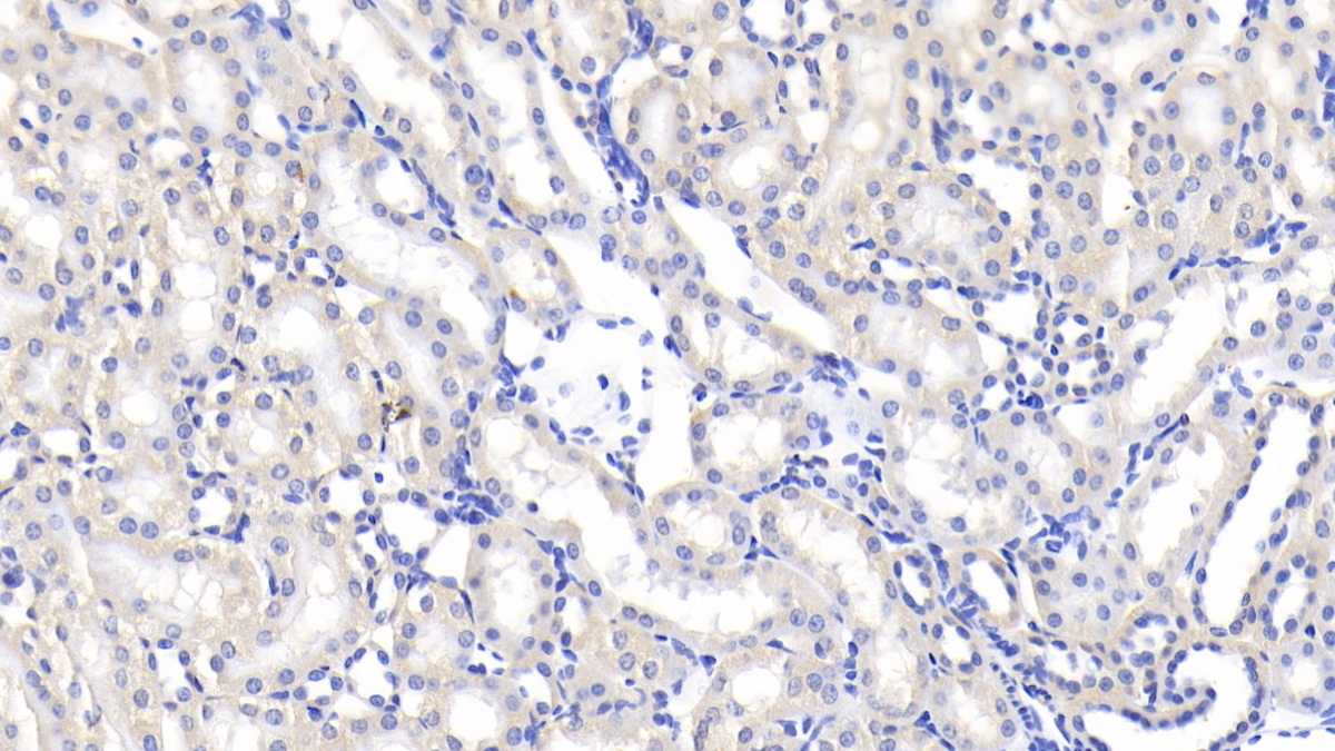 Polyclonal Antibody to Lipopolysaccharide Binding Protein (LBP)
