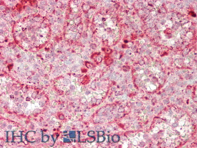 Polyclonal Antibody to Glucuronidase Beta (GUSb)