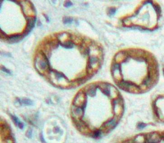 Polyclonal Antibody to Adenylate Cyclase 6 (ADCY6)