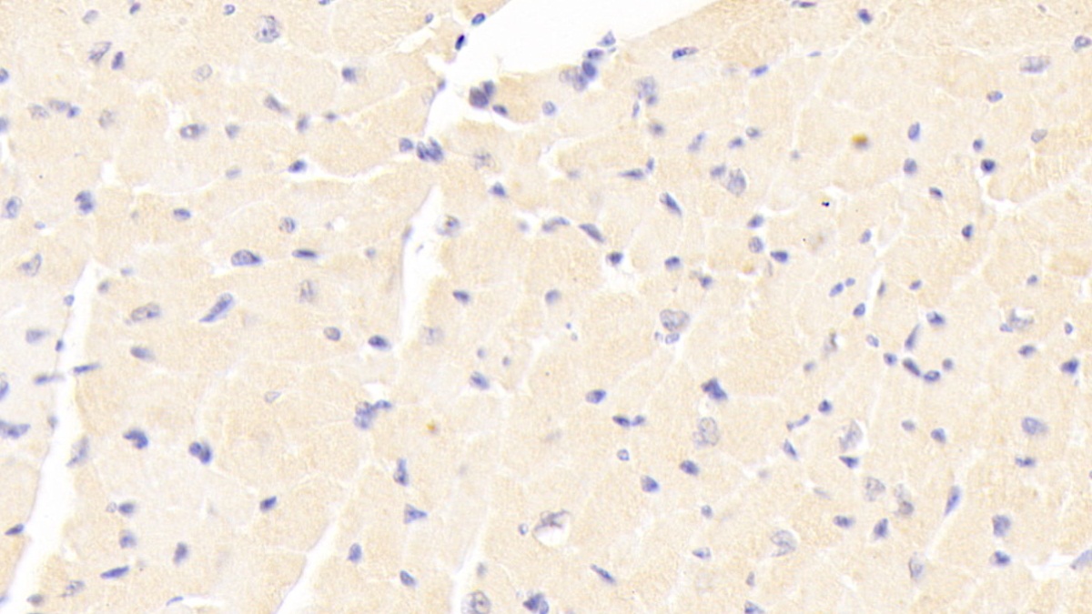 Polyclonal Antibody to Adenylate Cyclase 7 (ADCY7)