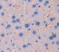 Polyclonal Antibody to Interferon Alpha/Beta Receptor 1 (IFNa/bR1)