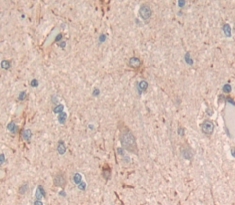 Polyclonal Antibody to Acetylcholinesterase (ACHE)