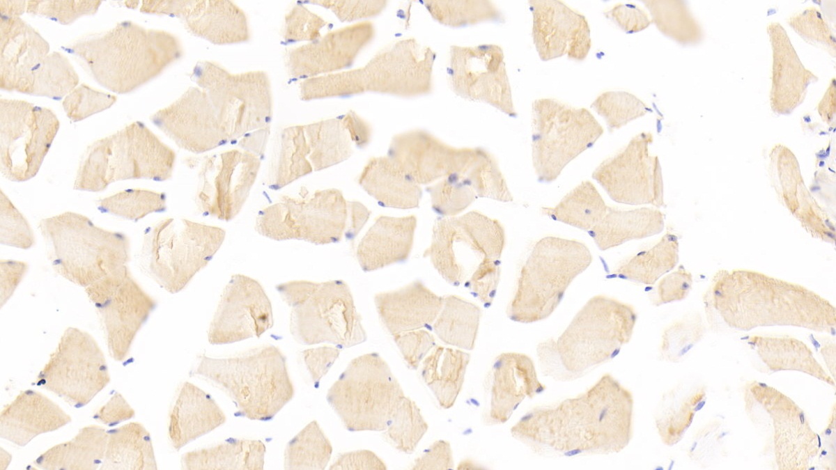 Polyclonal Antibody to Acetylcholinesterase (ACHE)