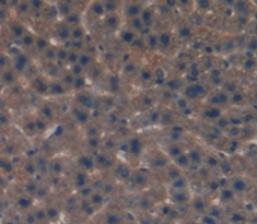 Polyclonal Antibody to Acetylcholinesterase (ACHE)