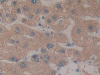 Polyclonal Antibody to Aminopeptidase B (RNPEP)