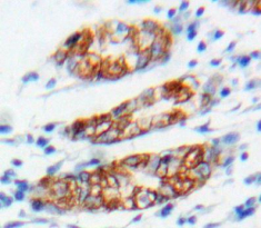 Polyclonal Antibody to Connexin 31 (CX31)