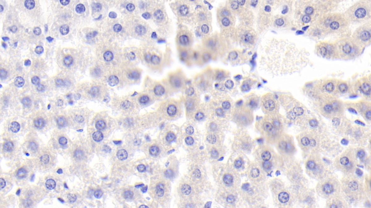 Polyclonal Antibody to Mannose Binding Lectin (MBL)