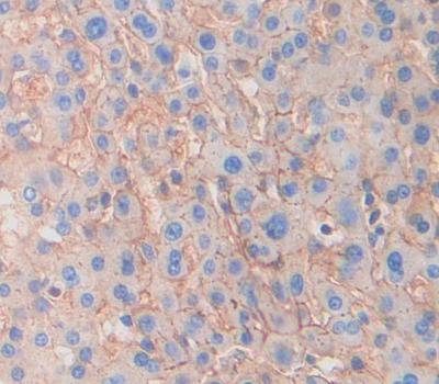 Polyclonal Antibody to N-cadherin (NCAD)