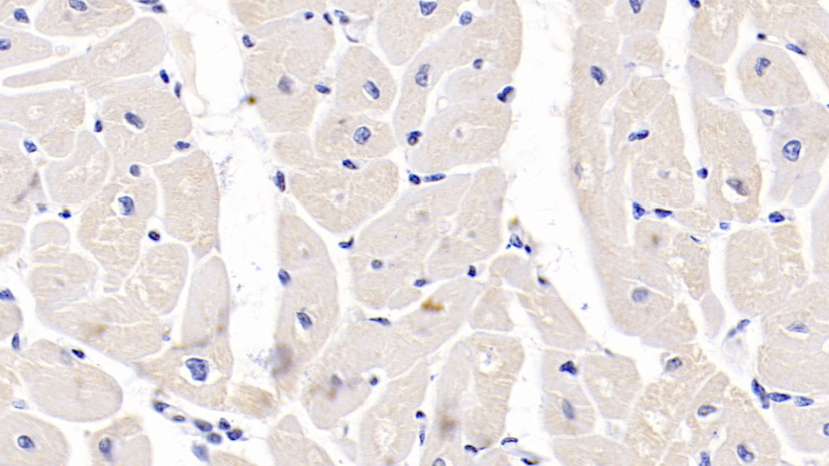 Polyclonal Antibody to Calreticulin (CALR)