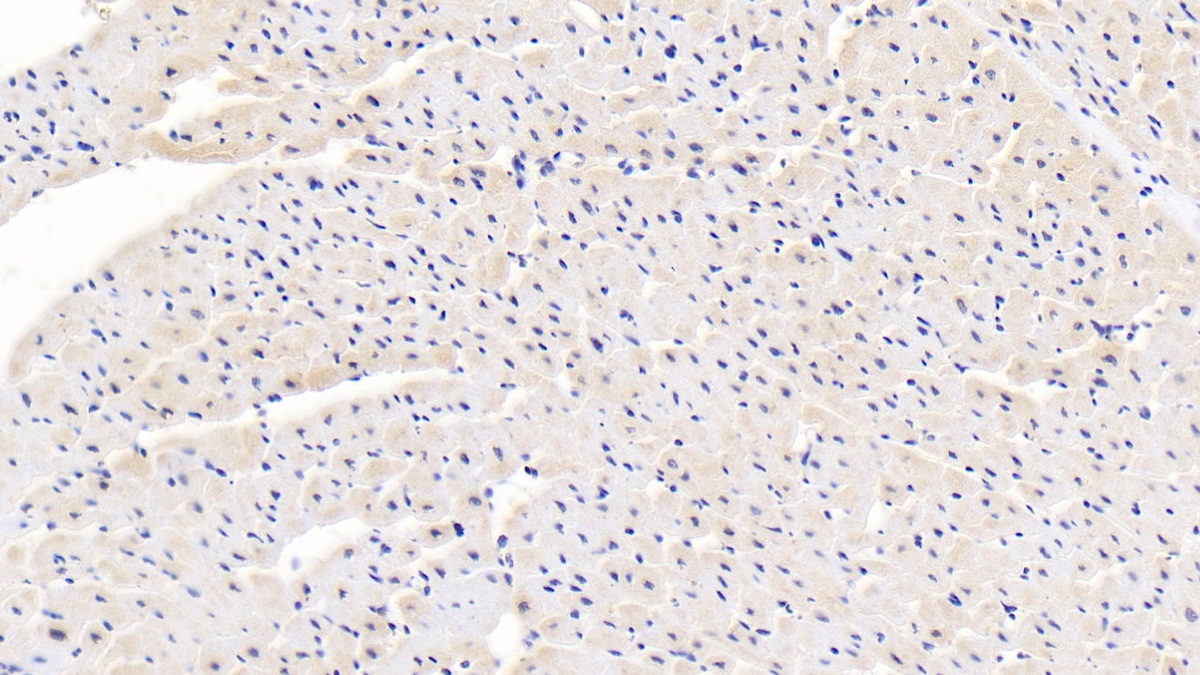 Polyclonal Antibody to Calreticulin (CALR)
