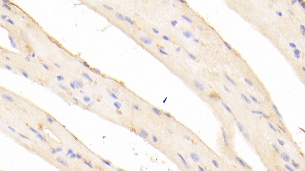 Polyclonal Antibody to Calreticulin (CALR)