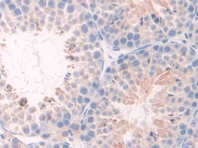 Polyclonal Antibody to Tumor Necrosis Factor Receptor 1 (TNFR1)