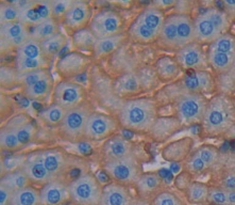 Polyclonal Antibody to Dystrophin (DMD)