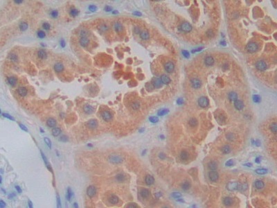 Polyclonal Antibody to Interleukin 1 Receptor Associated Kinase 2 (IRAK2)