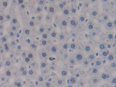 Polyclonal Antibody to Density Enhanced Phosphatase 1 (DEP1)