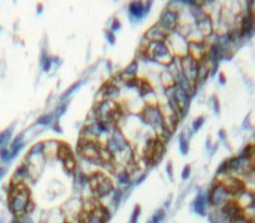 Polyclonal Antibody to Signaling Lymphocytic Activation Molecule Family, Member 1 (SLAMF1)