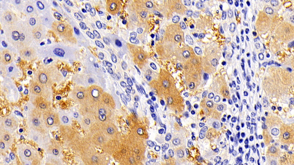 Polyclonal Antibody to Killer Cell Immunoglobulin Like Receptor 3DL1 (KIR3DL1)