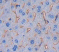 Polyclonal Antibody to Integrin Beta 2 (CD18)