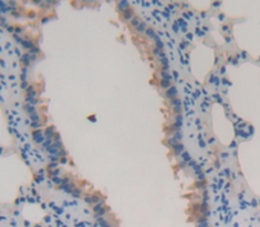 Polyclonal Antibody to Integrin Beta 2 (CD18)